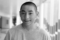 Active Tuberculosis Disease