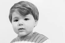 Clubfoot (Talipes Equinovarus)