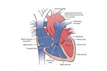 Heart Anatomy