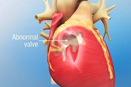 Heart Animation Teaser