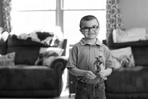 Duchenne Muscular Dystrophy (DMD)