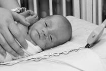 Newborn Clavicle Fractures