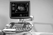 Developing an Algorithm for Ovarian Preservation