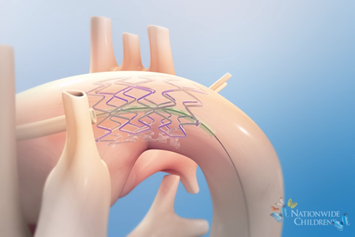 Animation: Hybrid Stage 1