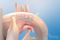 Hybrid Stage 1 Procedure