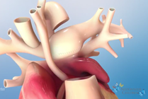 Hybrid Comprehensive Stage 2 Procedure